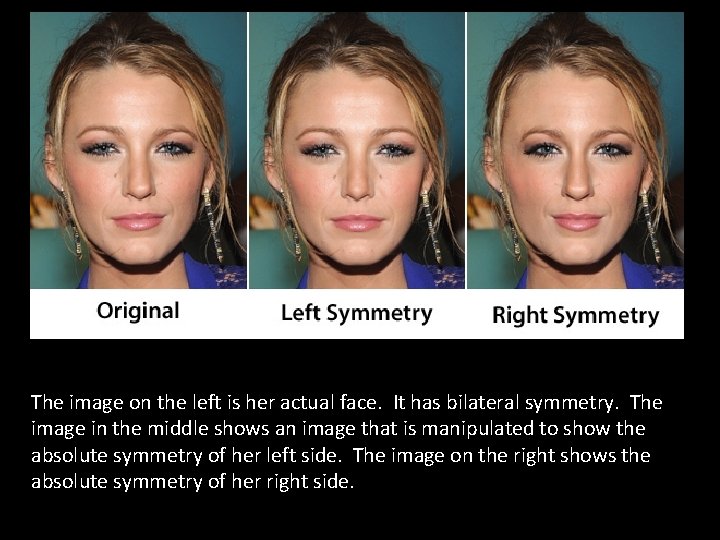 The image on the left is her actual face. It has bilateral symmetry. The