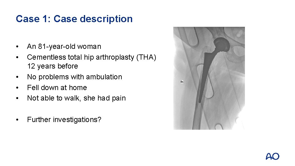Case 1: Case description • • • An 81 -year-old woman Cementless total hip