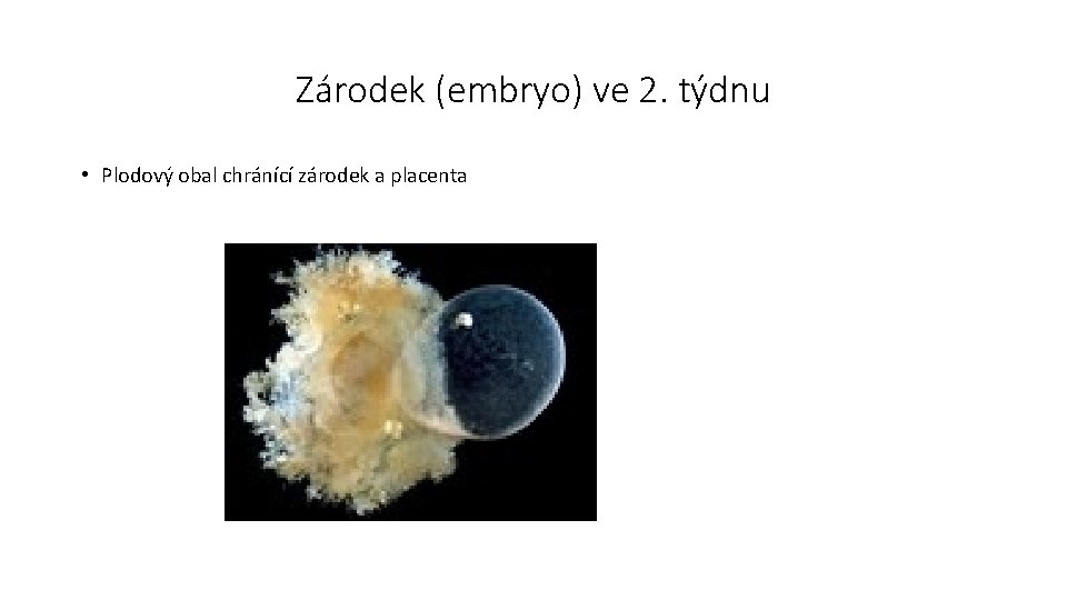 Zárodek (embryo) ve 2. týdnu • Plodový obal chránící zárodek a placenta 