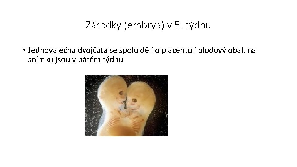 Zárodky (embrya) v 5. týdnu • Jednovaječná dvojčata se spolu dělí o placentu i