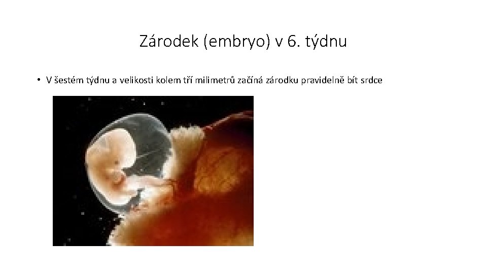 Zárodek (embryo) v 6. týdnu • V šestém týdnu a velikosti kolem tří milimetrů