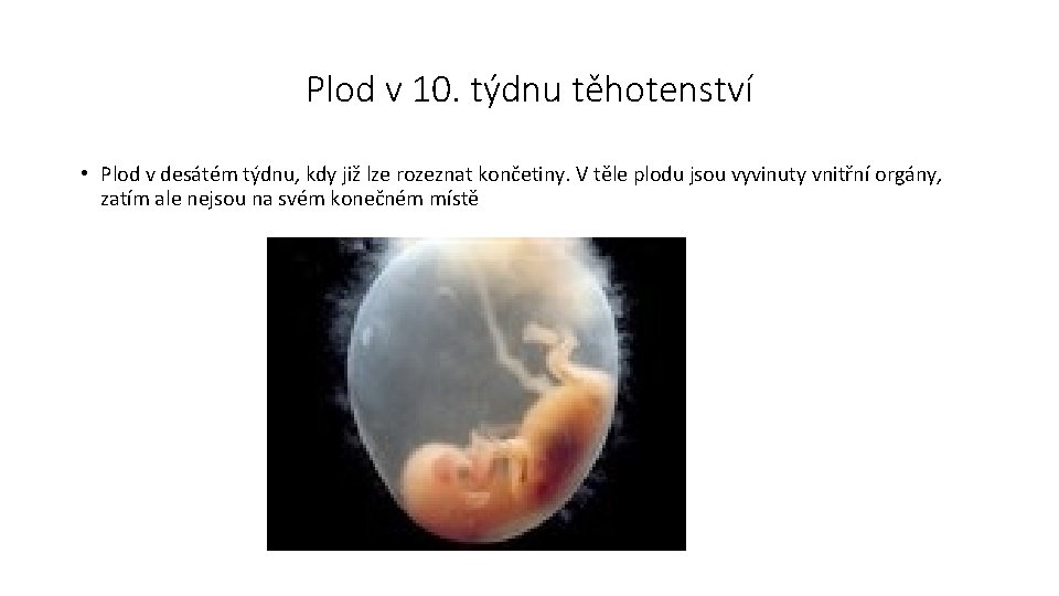 Plod v 10. týdnu těhotenství • Plod v desátém týdnu, kdy již lze rozeznat
