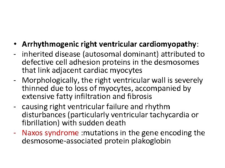  • Arrhythmogenic right ventricular cardiomyopathy: - inherited disease (autosomal dominant) attributed to defective