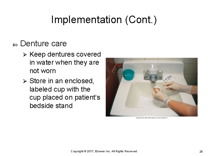 Implementation (Cont. ) Denture care Keep dentures covered in water when they are not