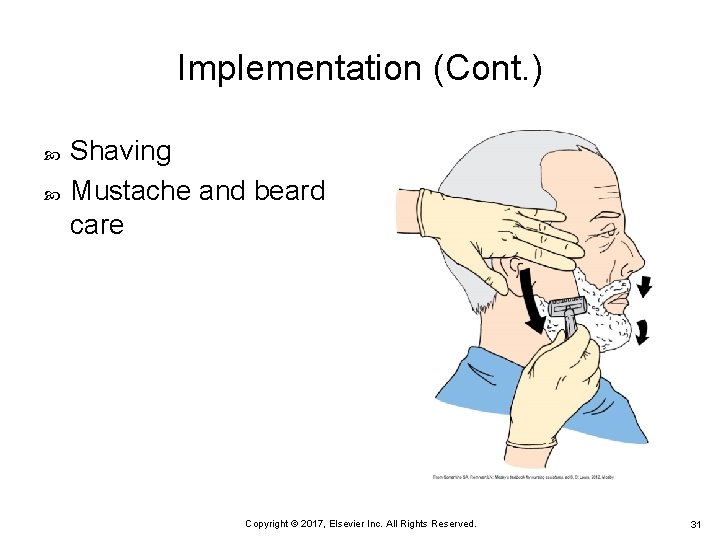 Implementation (Cont. ) Shaving Mustache and beard care Copyright © 2017, Elsevier Inc. All