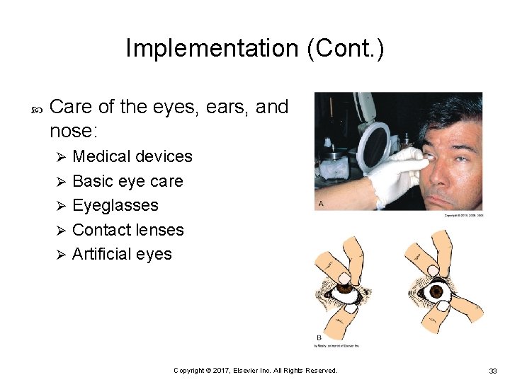 Implementation (Cont. ) Care of the eyes, ears, and nose: Medical devices Ø Basic