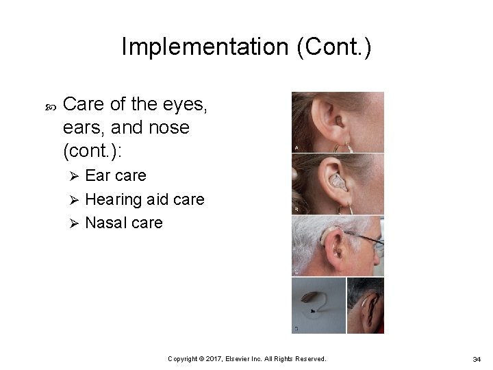 Implementation (Cont. ) Care of the eyes, ears, and nose (cont. ): Ear care