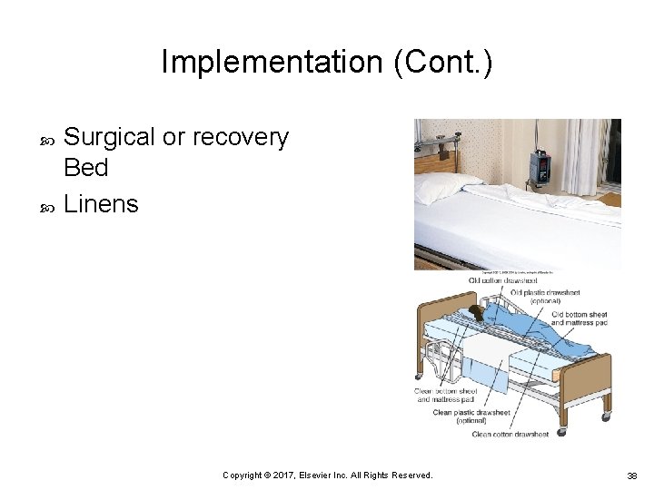 Implementation (Cont. ) Surgical or recovery Bed Linens Copyright © 2017, Elsevier Inc. All