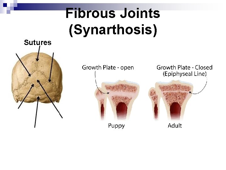 Fibrous Joints (Synarthosis) Sutures 