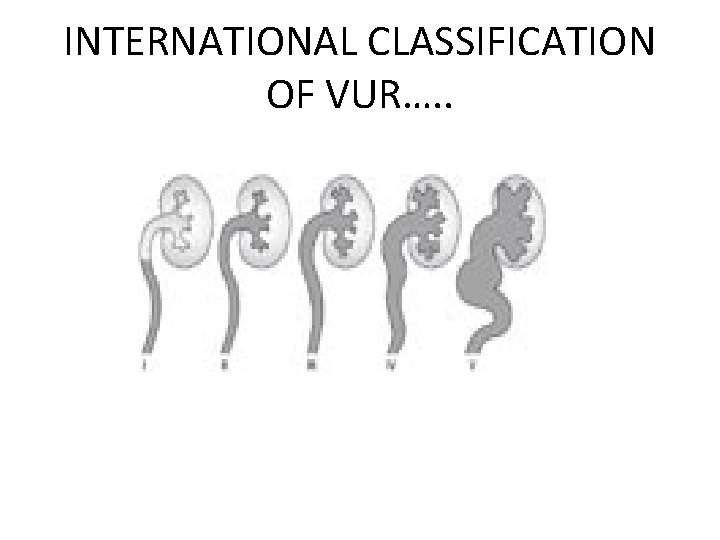 INTERNATIONAL CLASSIFICATION OF VUR…. . INTERNATIONAL CLASSIFICATION OF VUR…. .