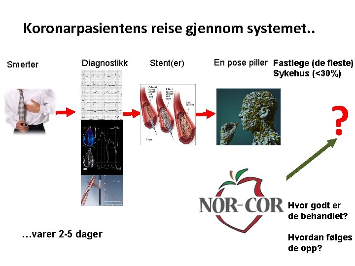 Koronarpasientens reise gjennom systemet. . Smerter Diagnostikk Stent(er) En pose piller Fastlege (de fleste)