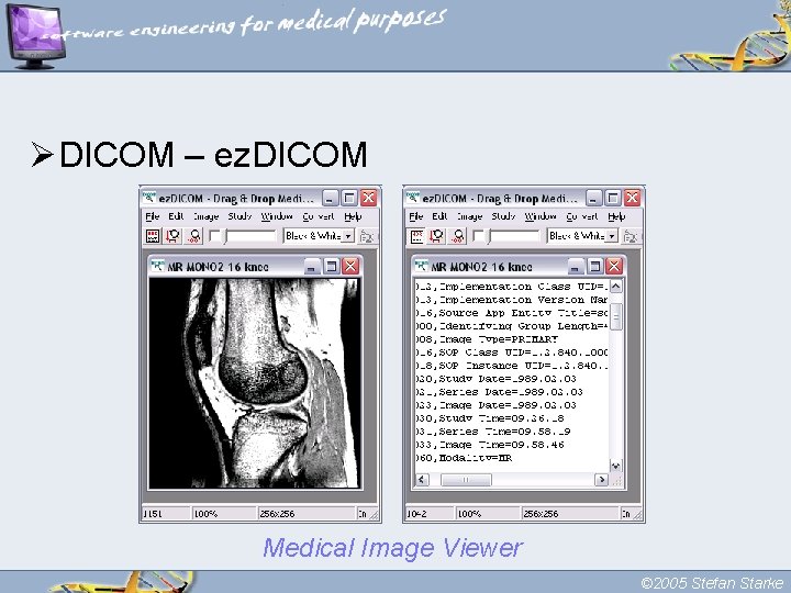 ØDICOM – ez. DICOM Medical Image Viewer © 2005 Stefan Starke 