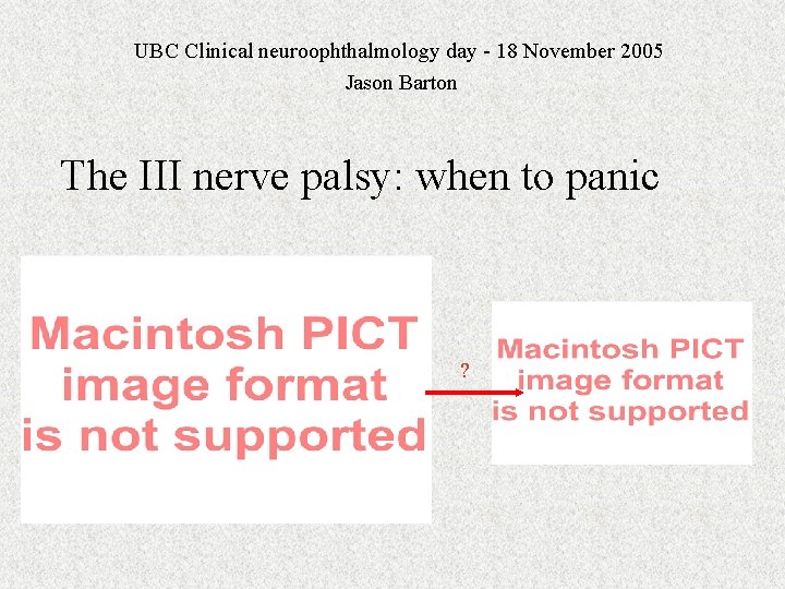 UBC Clinical neuroophthalmology day - 18 November 2005 Jason Barton The III nerve palsy: