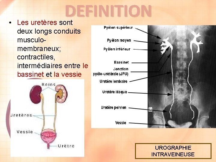 DEFINITION • Les uretères sont deux longs conduits musculomembraneux; contractiles, intermédiaires entre le bassinet