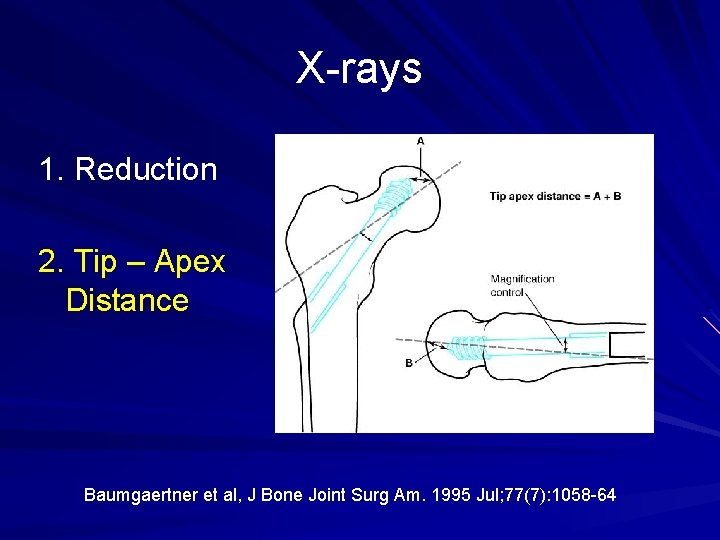 X-rays 1. Reduction 2. Tip – Apex Distance Baumgaertner et al, J Bone Joint