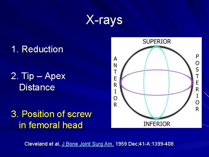 X-rays 1. Reduction 2. Tip – Apex Distance 3. Position of screw in femoral
