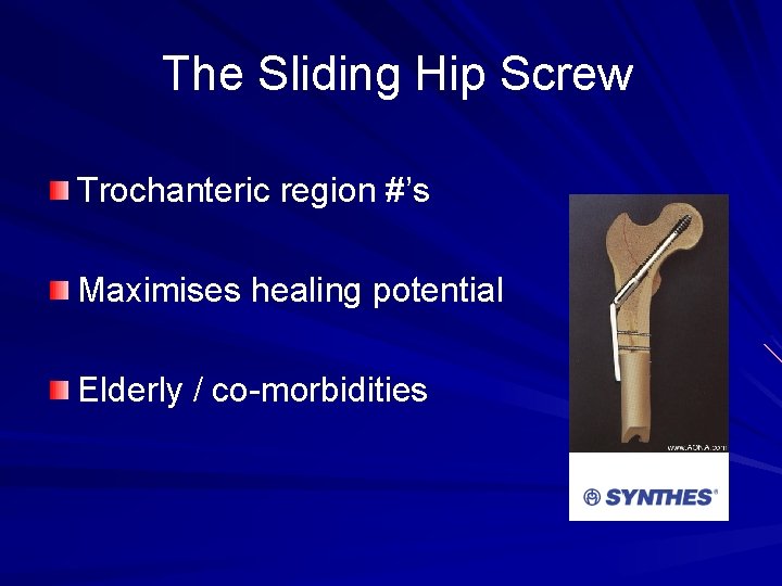 SLIDING HIP SCREW FIXATION FOR PROXIMAL FEMUR FRACTURES