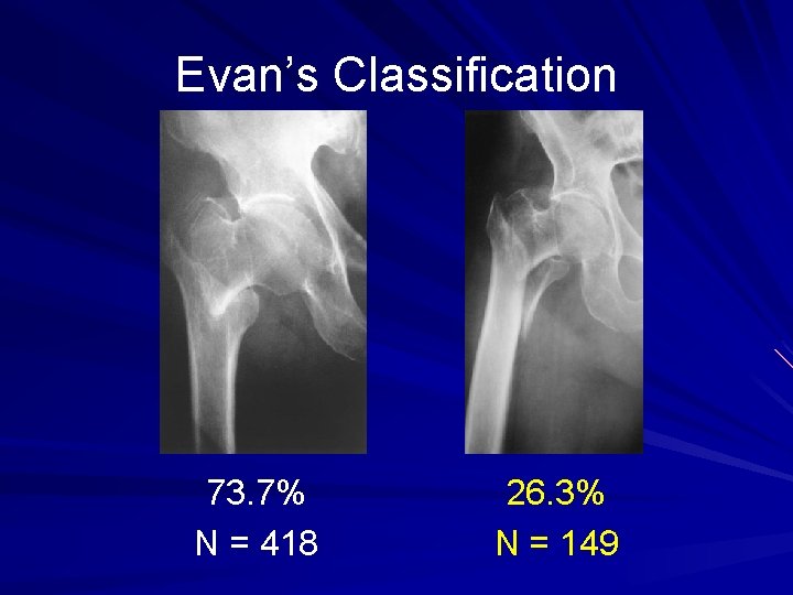 Evan’s Classification 73. 7% N = 418 26. 3% N = 149 
