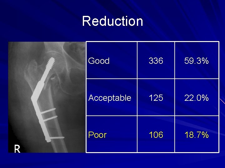 Reduction Good 336 59. 3% Acceptable 125 22. 0% Poor 106 18. 7% 
