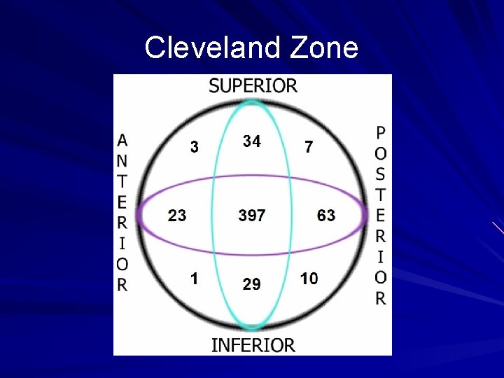 Cleveland Zone 