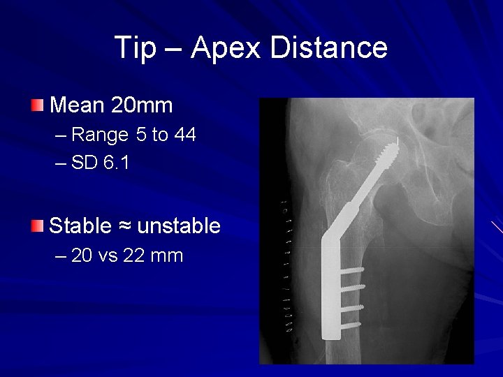 Tip – Apex Distance Mean 20 mm – Range 5 to 44 – SD
