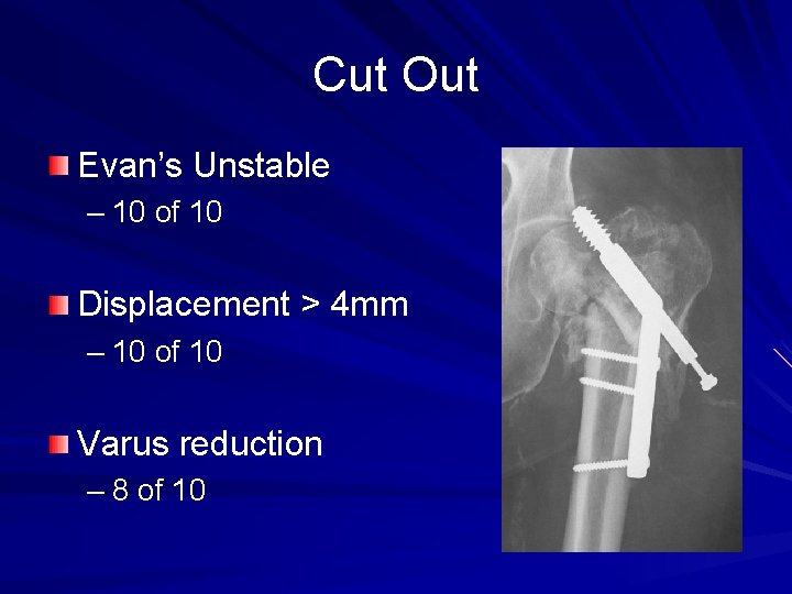 Cut Out Evan’s Unstable – 10 of 10 Displacement > 4 mm – 10