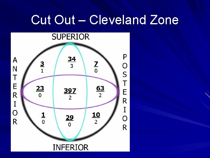 Cut Out – Cleveland Zone 