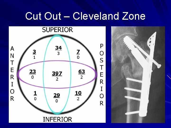 Cut Out – Cleveland Zone 