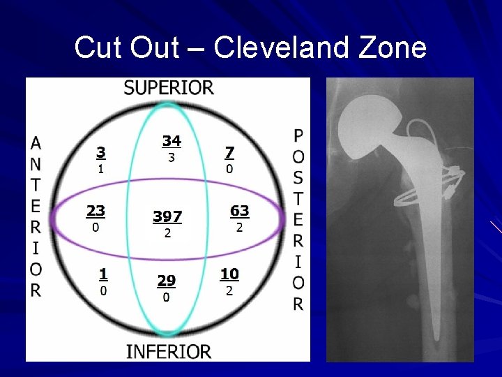 Cut Out – Cleveland Zone 