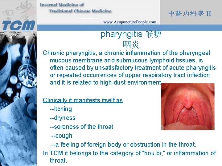 pharyngitis 喉痹 咽炎 Chronic pharyngitis, a chronic inflammation of the pharyngeal mucous membrane and