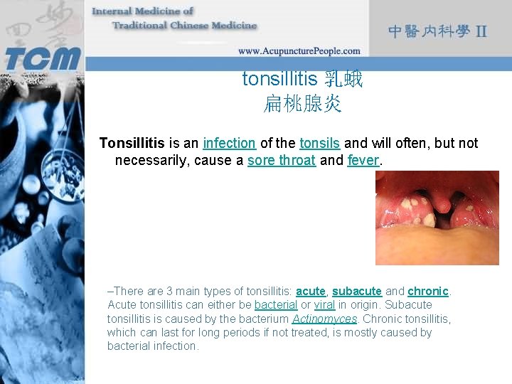 tonsillitis 乳蛾 扁桃腺炎 Tonsillitis is an infection of the tonsils and will often, but