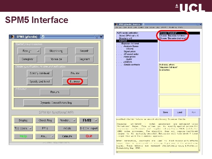 Spm Module Interface Estimating the Transfer Function from Neuronal Activity to