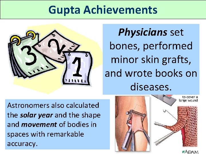 Gupta Achievements Physicians set bones, performed minor skin grafts, and wrote books on diseases.