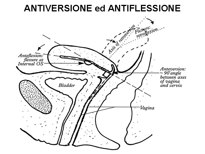 ANTIVERSIONE ed ANTIFLESSIONE 