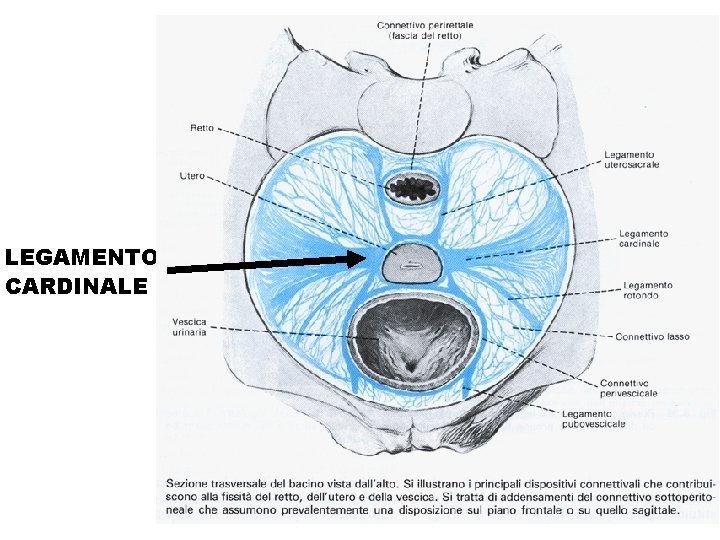 LEGAMENTO CARDINALE 