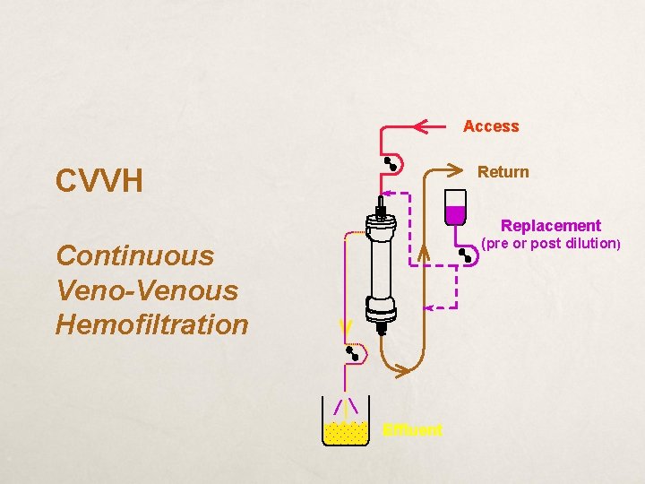 Access CVVH Return Replacement (pre or post dilution) Continuous Veno-Venous Hemofiltration Effluent 