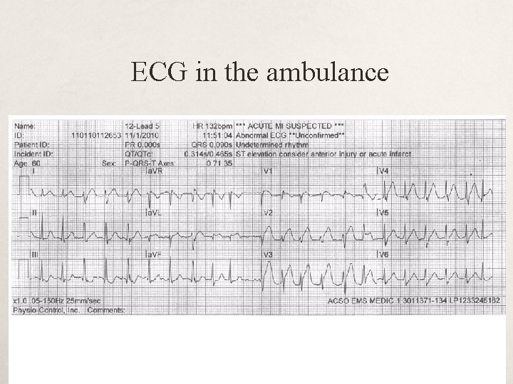 ECG in the ambulance 