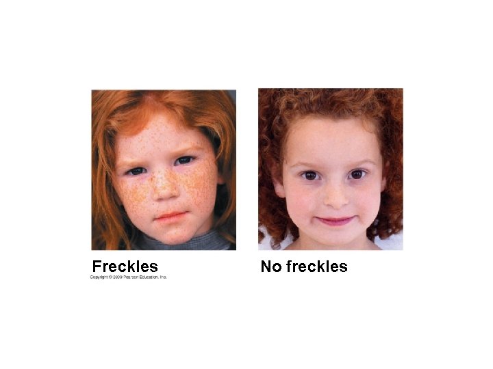 Freckles No freckles 