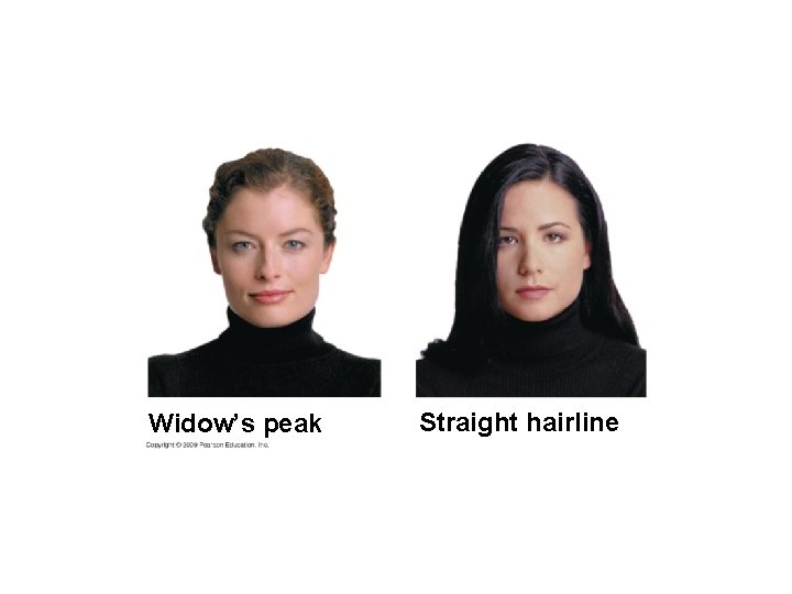 Widow’s peak Straight hairline 