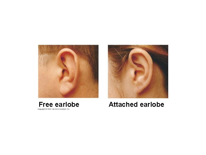 Free earlobe Attached earlobe 