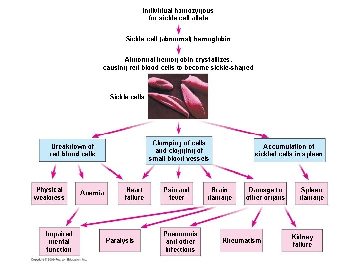 Individual homozygous for sickle-cell allele Sickle-cell (abnormal) hemoglobin Abnormal hemoglobin crystallizes, causing red blood