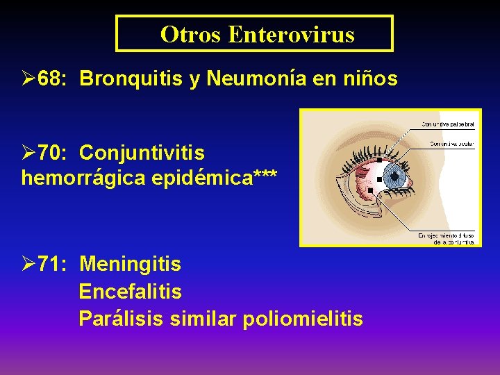Otros Enterovirus Ø 68: Bronquitis y Neumonía en niños Ø 70: Conjuntivitis hemorrágica epidémica***