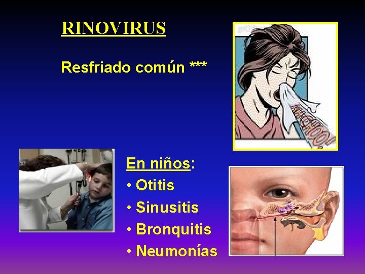 RINOVIRUS Resfriado común *** En niños: • Otitis • Sinusitis • Bronquitis • Neumonías