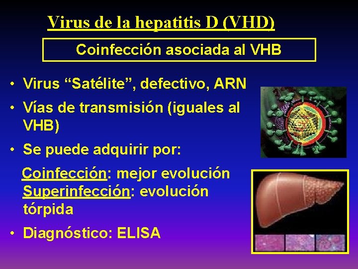 Virus de la hepatitis D (VHD) Coinfección asociada al VHB • Virus “Satélite”, defectivo,