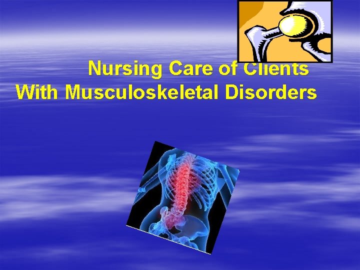 Nursing Care of Clients With Musculoskeletal Disorders 