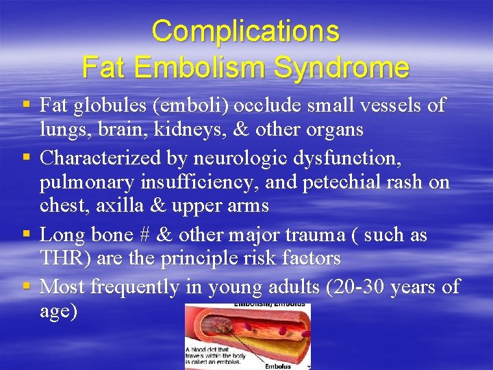 Complications Fat Embolism Syndrome § Fat globules (emboli) occlude small vessels of lungs, brain,