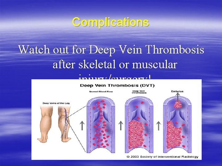 Complications Watch out for Deep Vein Thrombosis after skeletal or muscular injury/surgery! 