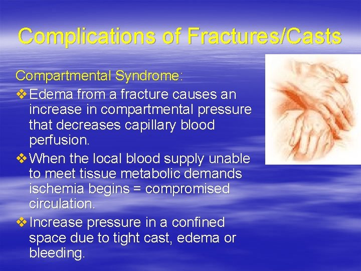 Complications of Fractures/Casts Compartmental Syndrome: v Edema from a fracture causes an increase in