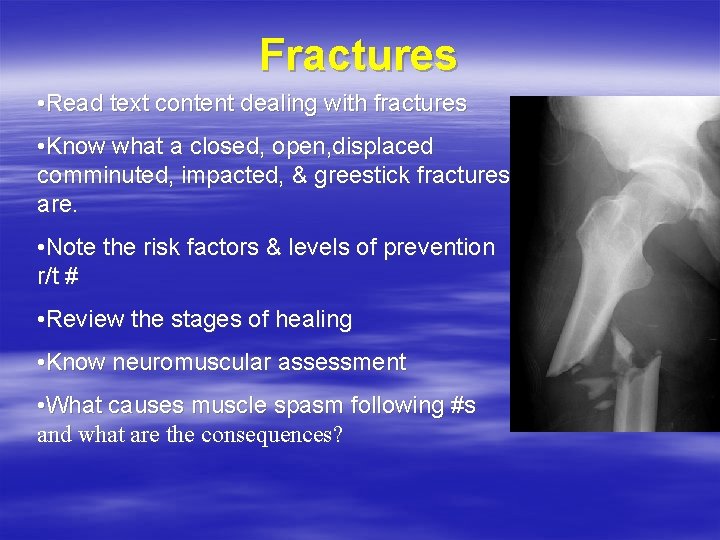 Fractures • Read text content dealing with fractures • Know what a closed, open,