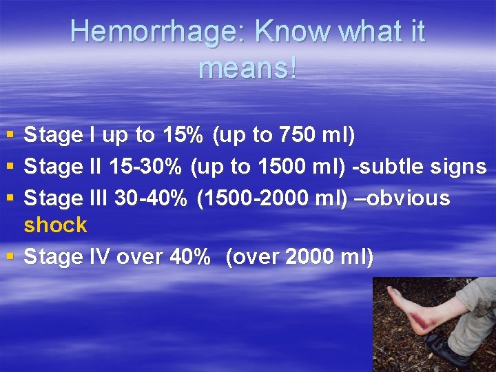 Hemorrhage: Know what it means! § Stage I up to 15% (up to 750